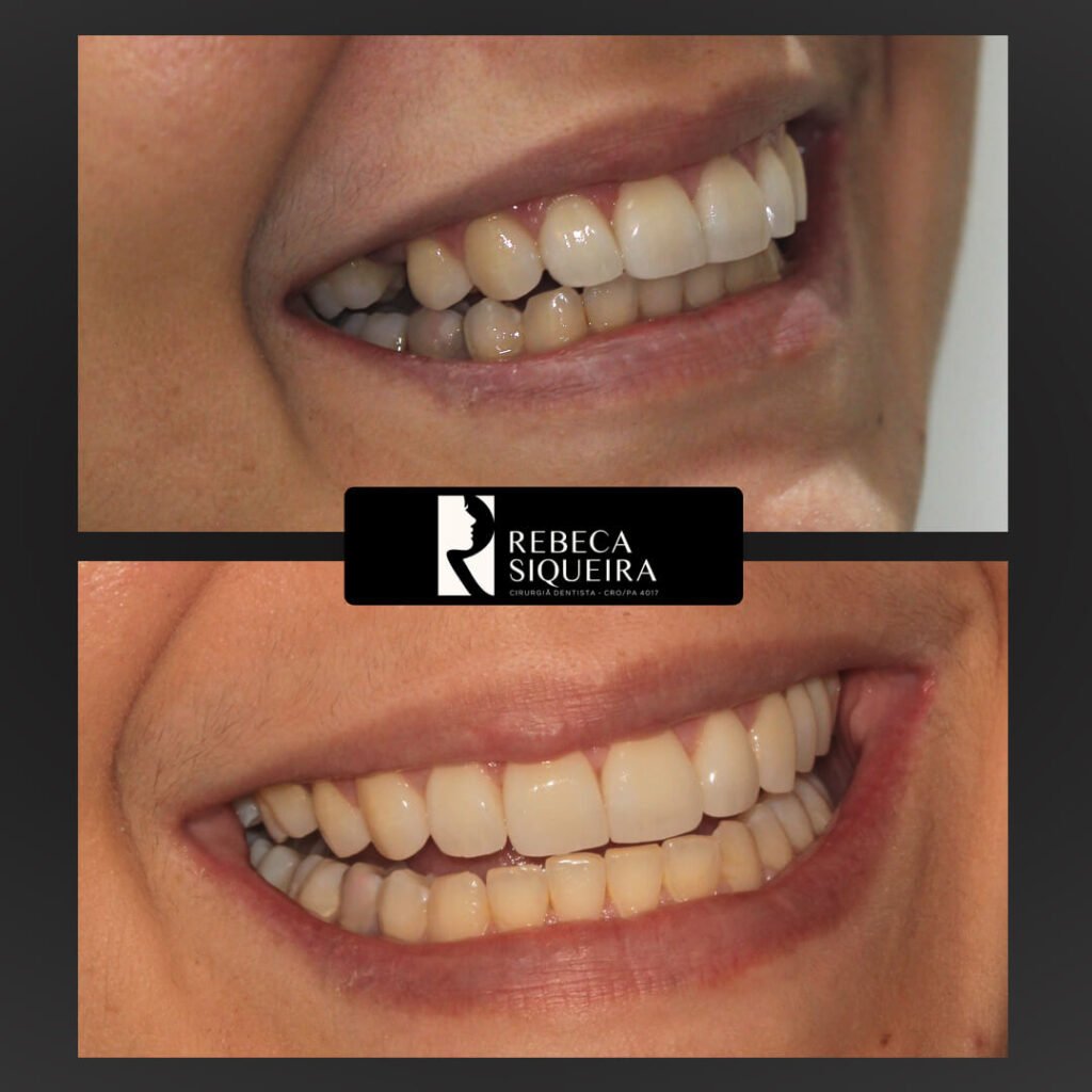 implante dentário Castanhal